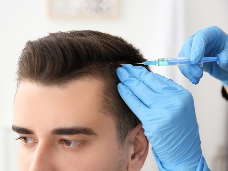 The Most Effective Hair Loss Treatments For 2019 Feed Inspiration