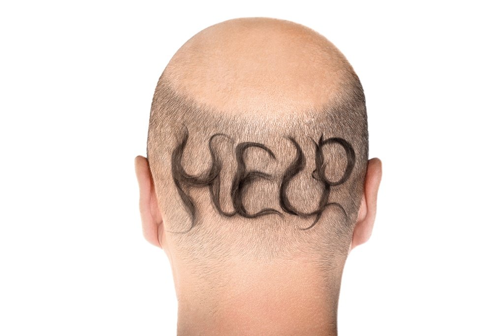 3 Ways A Scalp Tattoo Can Benefit Those With Hair Loss - Feed Inspiration
